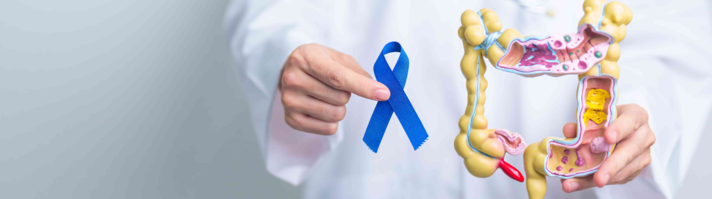 Colon & Colorectal Cancer