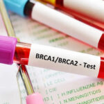 BRCA Gene Testing