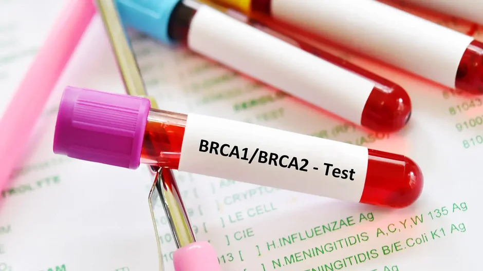 BRCA Gene Testing