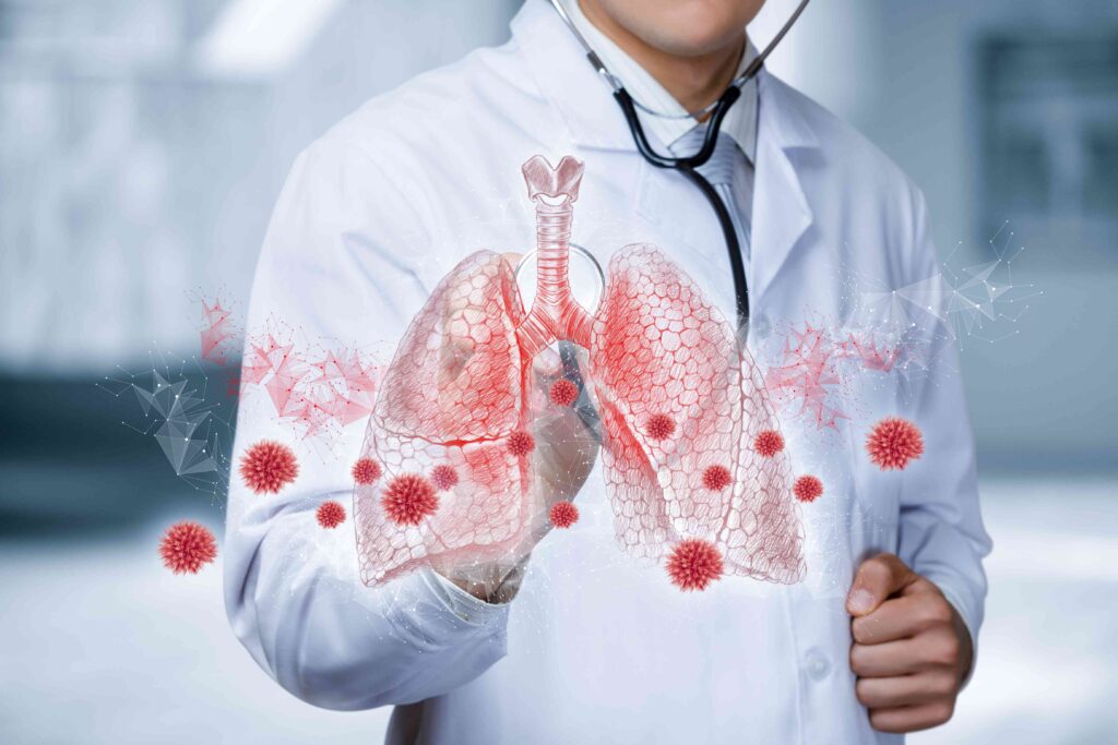 lung cancer treatment cost in India 2026