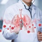 Lung cancer treatment cost in India 2026 lung cancer treatment cost in India 2026