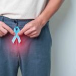 Prostate cancer treatment cost in India 2026 Prostate Cancer Treatment Cost in India 2026